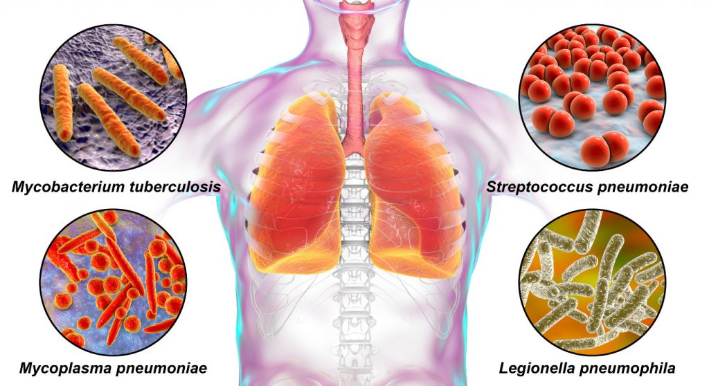 What Are the Methods of Legionnaires Disease Disinfections?